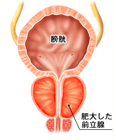 勃起不全の新薬